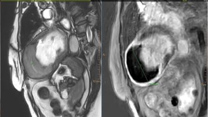 Presentation thumbnail