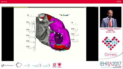 Substrate modification or ventricular tachycardia induction, mapping, and ablation as the first step? A randomized study
