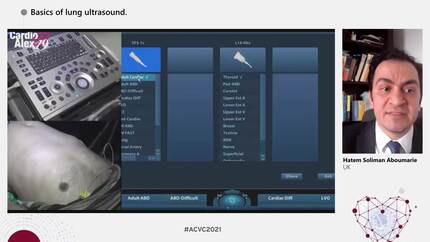 Basics of lung ultrasound.