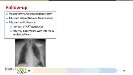 Multidisciplinary approach in cardio-oncology: putting words into action