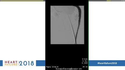 Presentation thumbnail