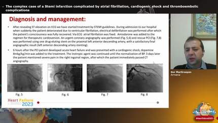 Presentation thumbnail