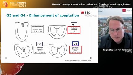 Presentation thumbnail