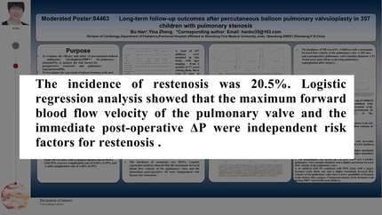 Long-term follow-up outcomes after percutaneous balloon pulmonary valvuloplasty in 357 children with pulmonary stenosis