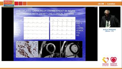 Presentation thumbnail