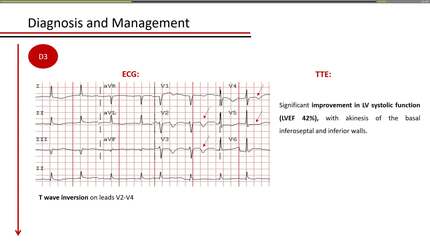 Severe left ventricular dysfunction caused by carbon monoxide poisoning