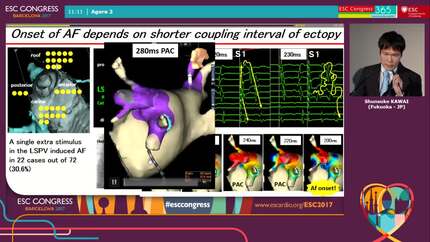 Location and coupling interval of ectopic beats have key roles in the onset of atrial fibrillation from the pulmonary veins