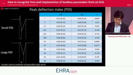 How to recognize free-wall implantation of leadless pacemaker from an ECG.
