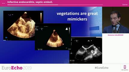 Presentation thumbnail
