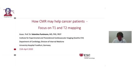 How cardiovascular magnetic resonance may help cancer patients?