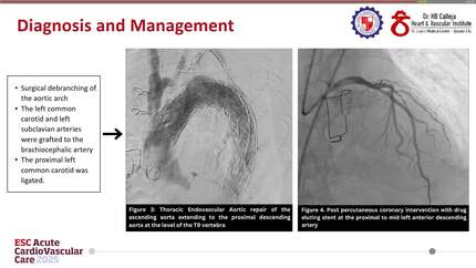 Presentation thumbnail
