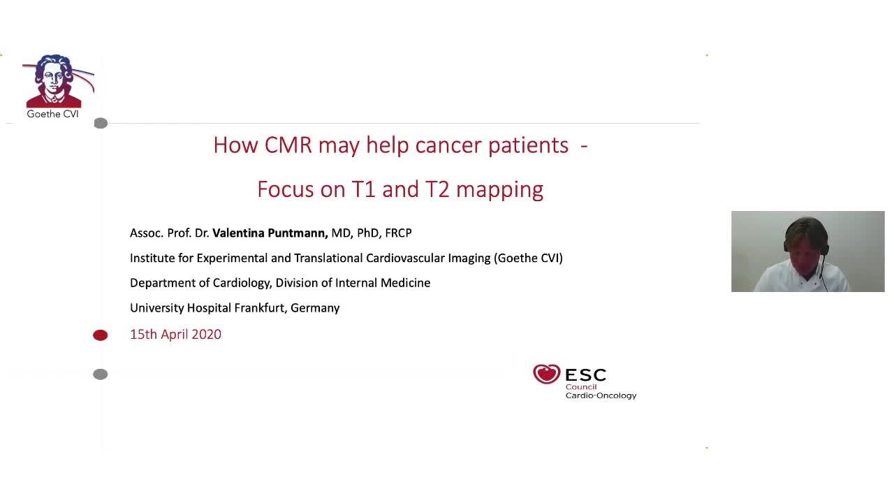 How cardiovascular magnetic resonance may help cancer patients?