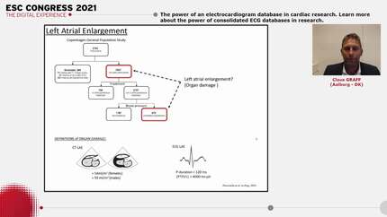 The power of an electrocardiogram database in cardiac research.
Learn more about the power of consolidated ECG databases in research.