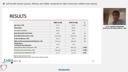 Left bundle branch pacing: efficacy and safety compared to right ventricular outflow tract pacing. 