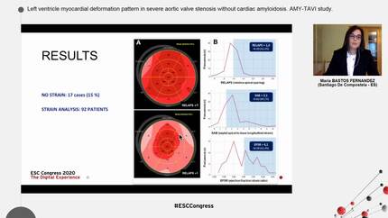 Left ventricle myocardial deformation pattern in severe aortic valve  stenosis without cardiac amyloidosis. The AMY-TAVI trial