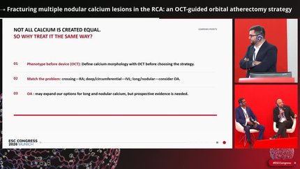 Fracturing multiple nodular calcium lesions in the RCA: an OCT-guided orbital atherectomy strategy