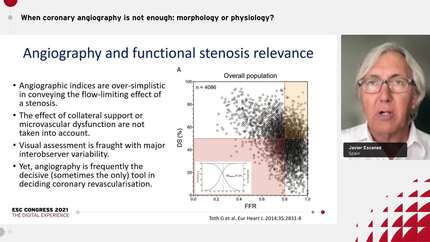 When coronary angiography is not enough: morphology or physiology?