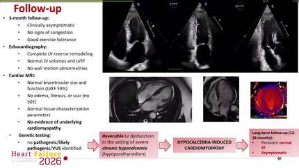 Hidden in the details: severe hypocalcemia-induced cardiomyopathy in de novo HFrEF with complete recovery after correction of idiopathic hypoparathyroidism