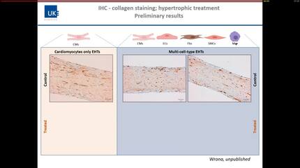 Induced pluripotent stem cells for heart disease