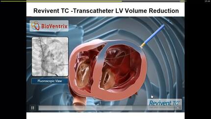 Presentation thumbnail