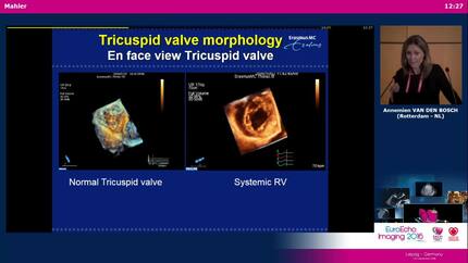Presentation thumbnail