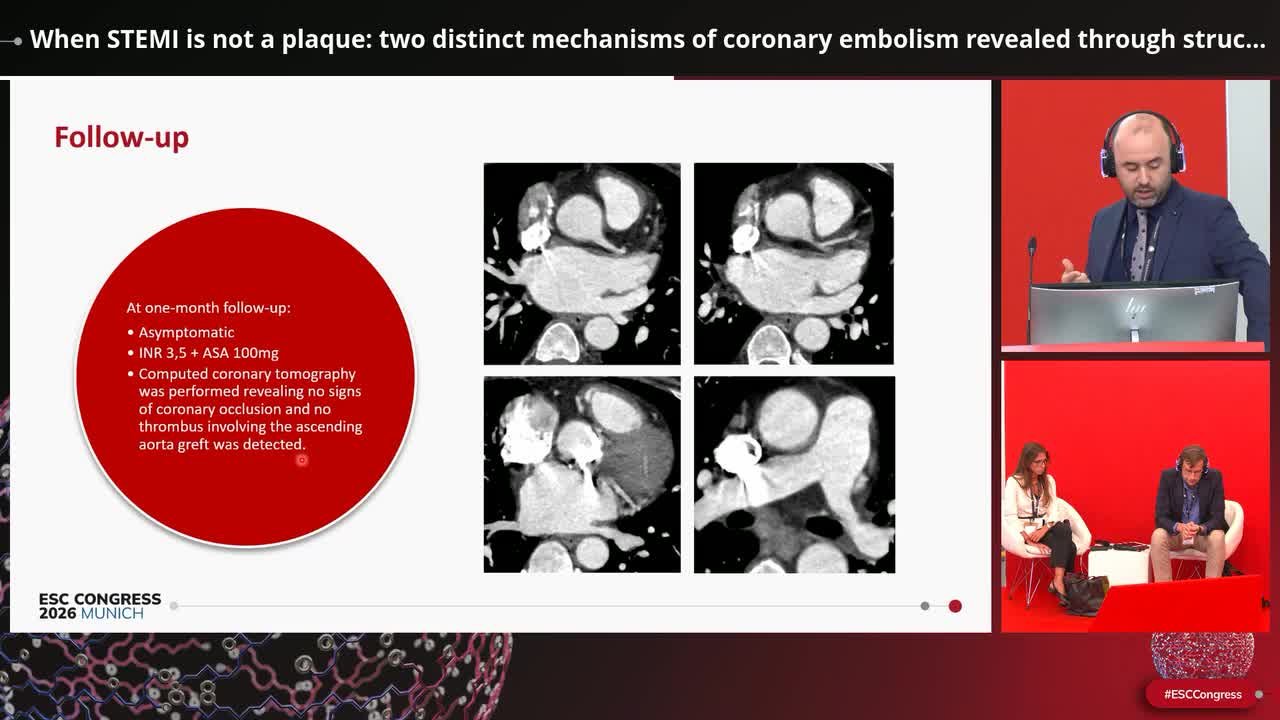 When STEMI is not a plaque: two distinct mechanisms of coronary embolism revealed through structured multimodality diagnostic workup