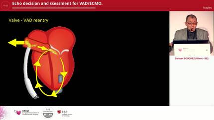 Echo decision and ssessment for VAD/ECMO.