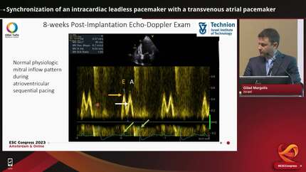 Synchronization of an intracardiac leadless pacemaker with a transvenous atrial pacemaker