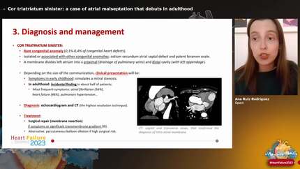 Cor triatriatum sinister: a case of atrial malseptation that debuts in adulthood