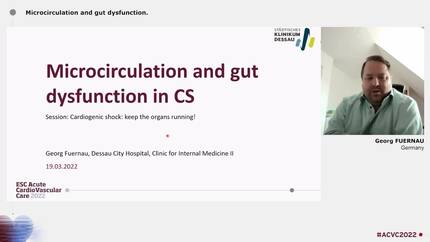 Cardiogenic shock: keep the organs running!