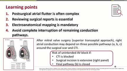 Scar-related biatrial flutter after mitral valve repair
