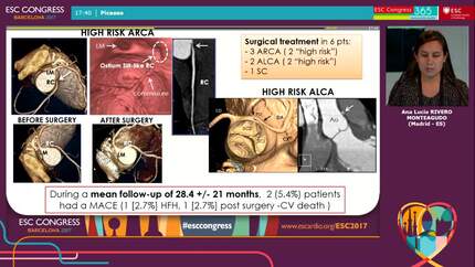 Prevalence and characteristics of anomalous coronary arteries origin from the opposite side in an unselected population of patients undergoing computed tomographic angiography