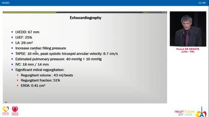 Case presentation: a patient with valvular disease