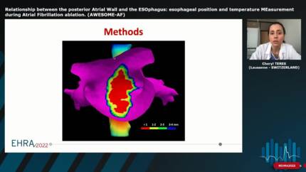 High-Power Short Duration Ablation for Pulmonary Vein Isolation