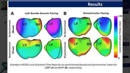 Defining ECG imaging resynchronisation criteria for improved cardiac resynchronisation therapy in LBBB patients