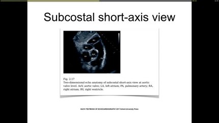 Presentation thumbnail