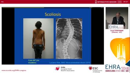 Presentation thumbnail