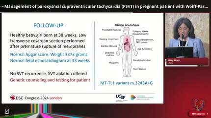 Supraventricular tachycardia (2)
