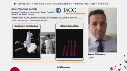 Coming next in imaging to guide structural heart interventions: virtual reality and more.