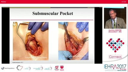 Presentation thumbnail