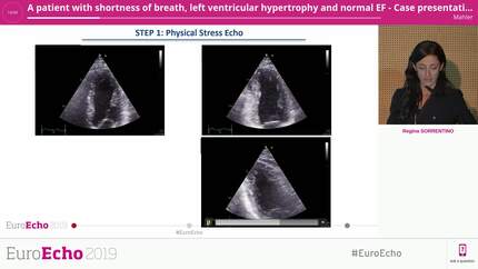 A patient with shortness of breath, left ventricular hypertrophy and normal EF - Case presentation.