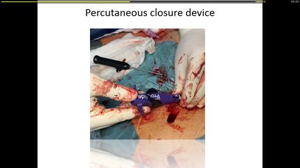 Presentation thumbnail