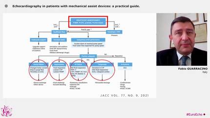Echocardiography on the edge: added value in the critical patient