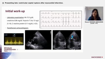 Presenting late: ventricular septal rupture after myocardial infarction.