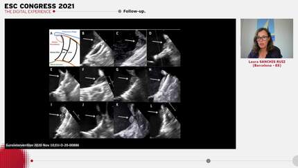Presentation thumbnail