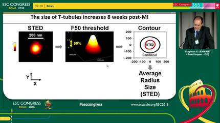 Cardiac electrical sensing and electromechanical stimulation.