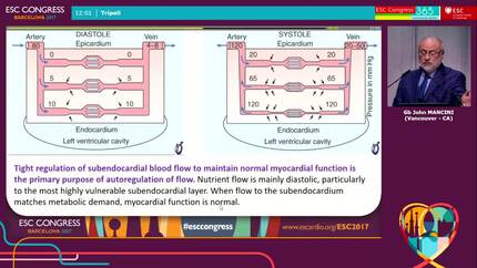 Invasive FFR: the ultimate decision maker?