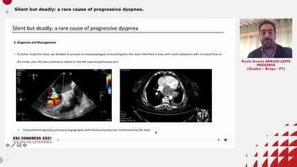 Silent but deadly: a rare cause of progressive dyspnea.