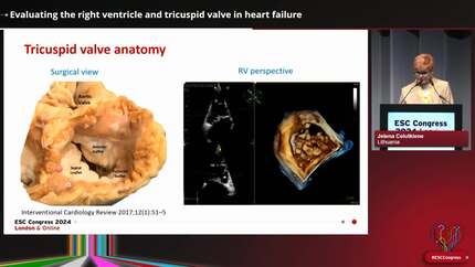 Presentation thumbnail