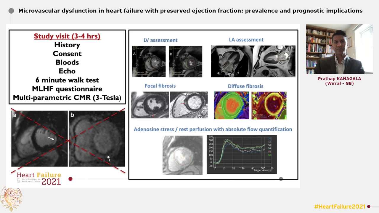 Microvascular dysfunction in heart failure with preserved ejection fraction: prevalence and prognostic implications
